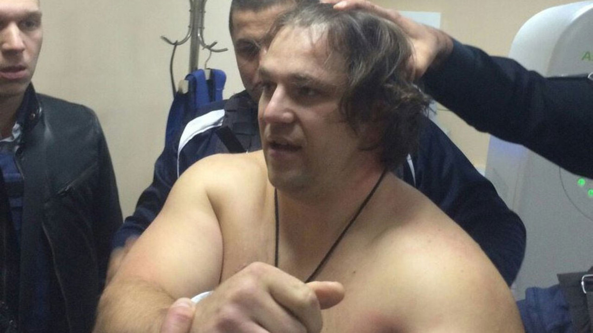 Олексанр Пугачов отримав поранення при затриманні - фото 1