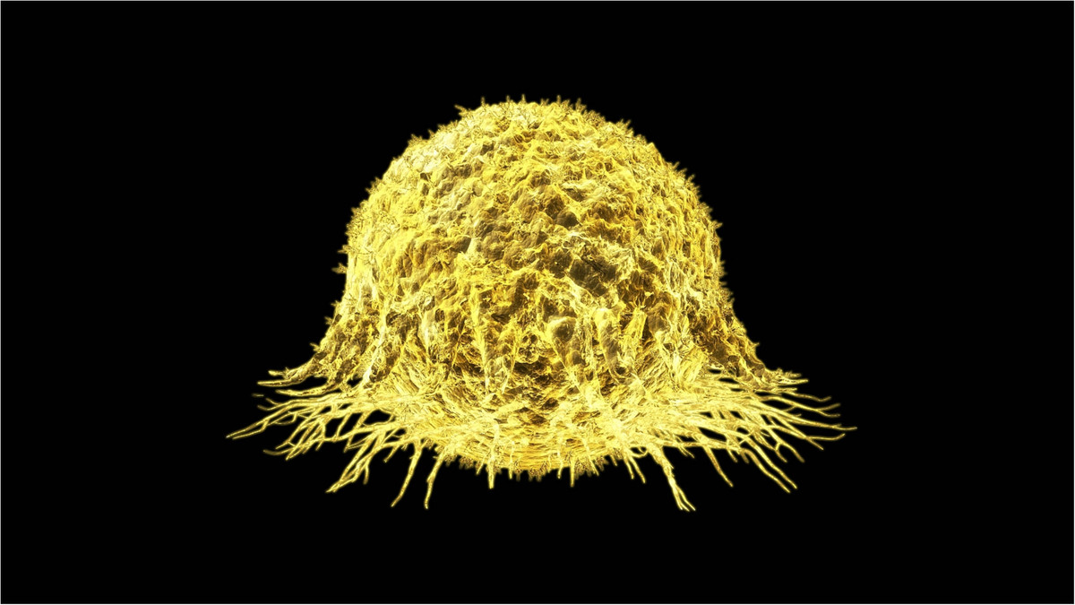 Ракові клітини - фото 1